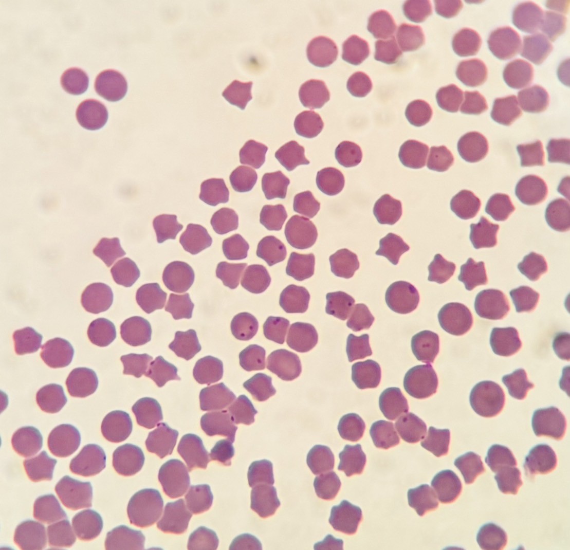 症例紹介：ヘモプラズマ感染症（旧ヘモバルトネラ感染症） あらた動物病院｜横浜市旭区善部町の動物病院｜犬 猫｜土日祝日診療